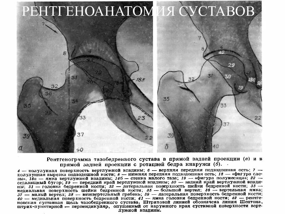 Проекции рентгена тазобедренного сустава. Нормальная рентген анатомия тазобедренного сустава. рентген анатомия тазобедренных суставов норма. тазобедренный сустав рентген анатомия. рентгенанатомтя бедреннойкости.