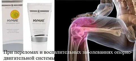 Мумие при переломах костей