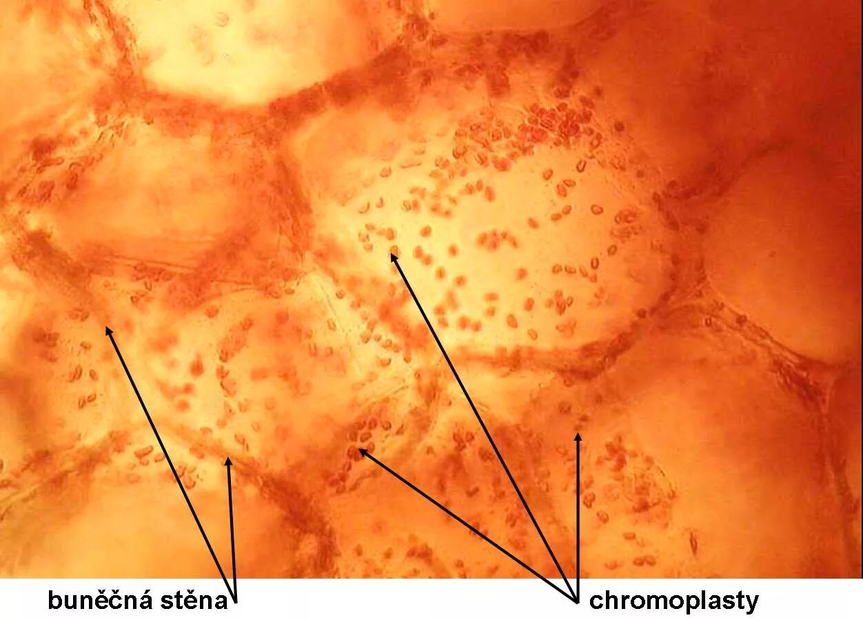 Клетка мякоти рябины. Хромопласты томата микроскопом. Хромопласт микрофотография. Хромопласты моркови микроскопом. Хромопласты шиповника.
