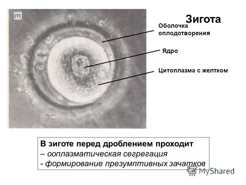 Начальные этапы эмбрионального развития человека. Оболочки зиготы. Образование зиготы рисунок. Морула бластула. Оболочки зиготы.
