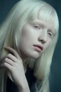 Женщина альбинос