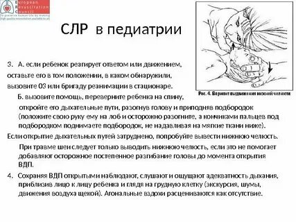 Сердечная реанимация детям