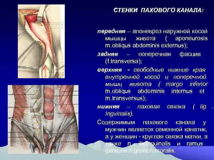 Болит паховая область у мужчин. Стенки пахового канала топографическая анатомия. Мышцы живота паховый канал вид спереди и справа. Передняя стенка пахового канала. Наружное отверстие пахового канала топографическая анатомия.