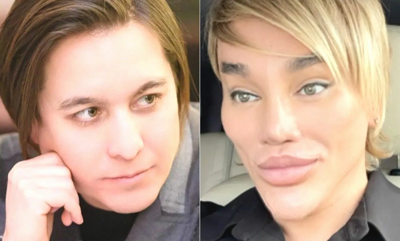 после операции хайдарова