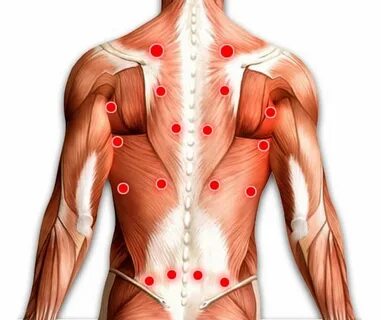 Подключичная мышца триггерные точки.
