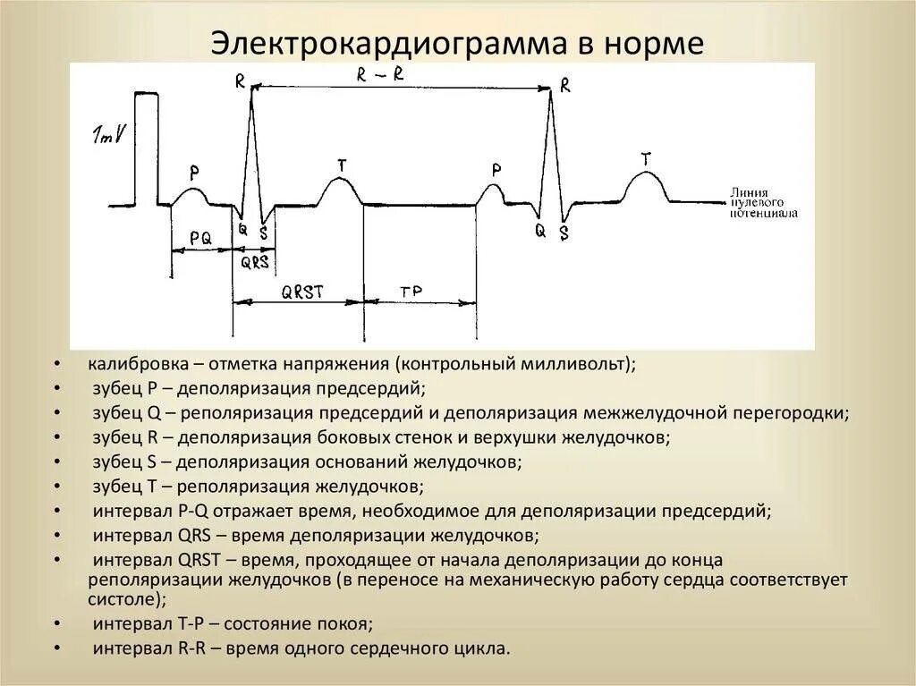 Длительность интервалов на ЭКГ норма. Нормы зубцов и интервалов ЭКГ. ЭКГ схема зубцов и интервалов. Нормы зубцов ЭКГ. Экг со скольки