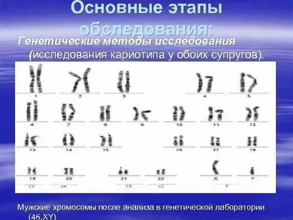 В кариотипе яблони 34