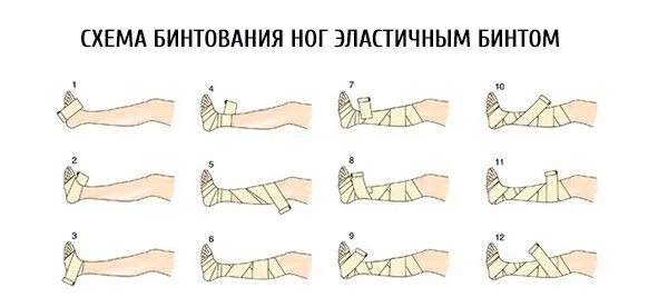 Как бинтовать ноги эластичным бинтом после операции