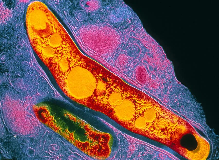 Туберкулез tuberculosis. Палочка Коха Mycobacterium tuberculosis. Палочка Коха микрофотография. Микобактериум туберкулёзис. Микобактерии туберкулеза микроскопия.