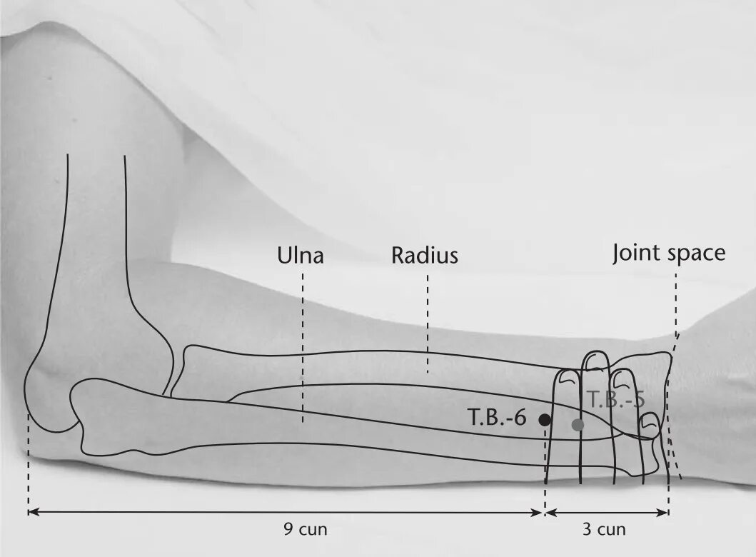 Tr6 точка акупунктуры Джи гоу. Tr 6 точка акупунктуры. Точка tr5 вай-Гуань. Вай Гуань точка акупунктуры. Гоу джи