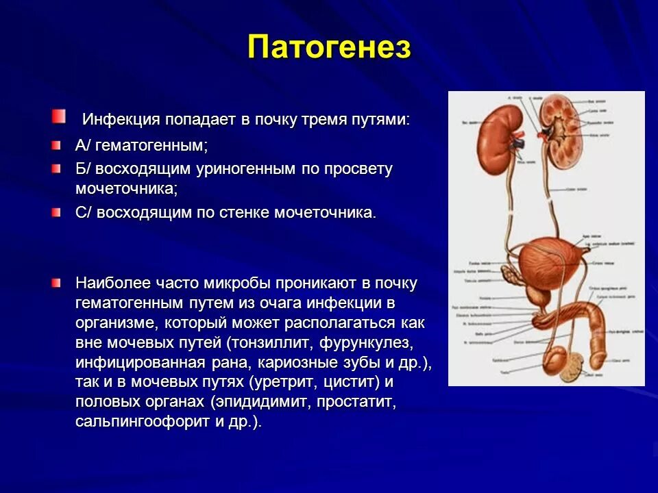 Инфекция мочевых путей патогенез. Этиология болезней мочевыделительной системы. Этиология заболеваний мочевыводящих путей. Мочевыделительная система заболевания 8 класс.