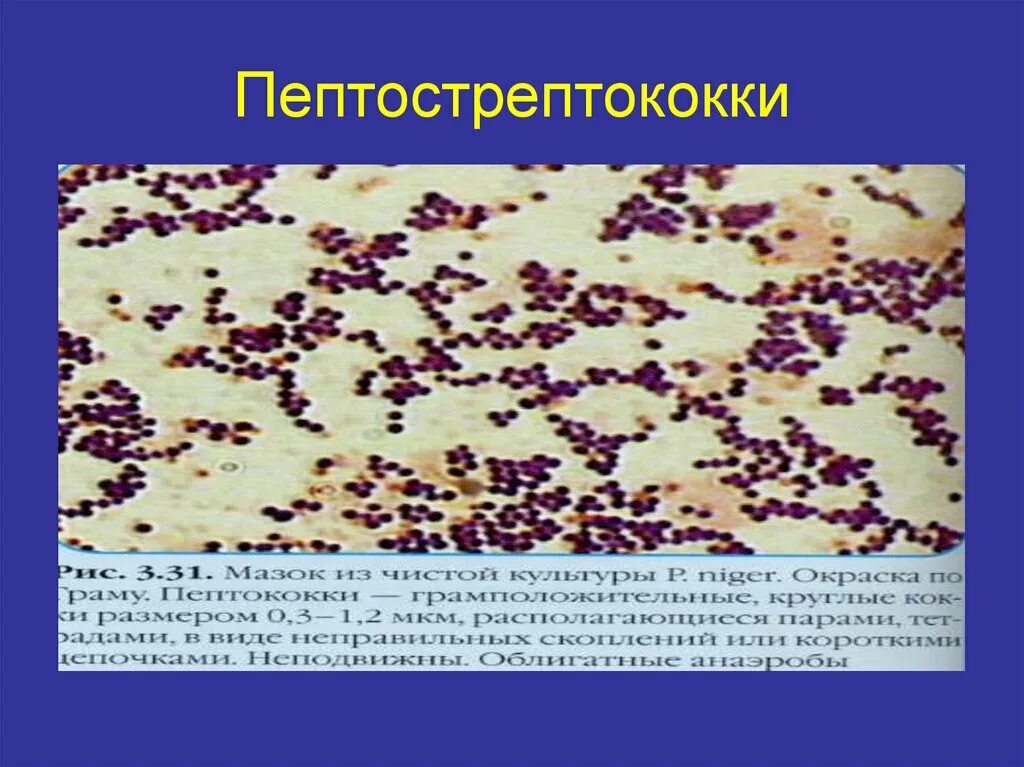 Пептококки и пептострептококки. Морфология пептострептококков. Пептострептококки фузобактерии. Анаэробные стрептококки пептострептококки.