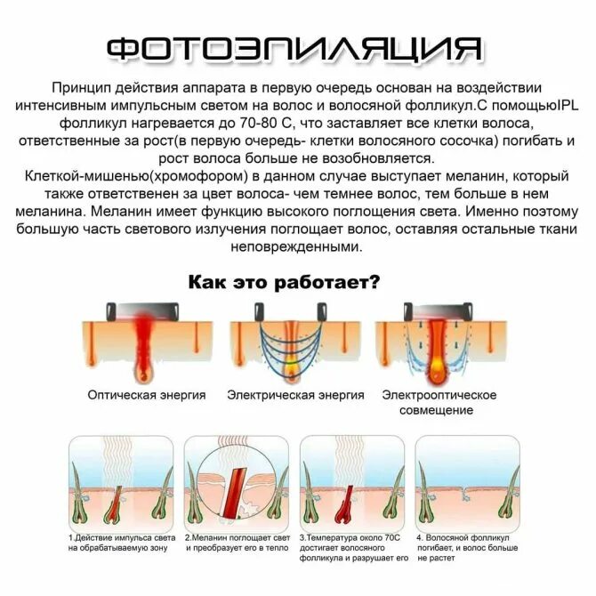 Как часто можно делать лазерную. Параметры диодного лазера для эпиляции. Принцип действия лазера для эпиляции. Принцип работы диодного лазера. Принцип работы диодного лазера для эпиляции.