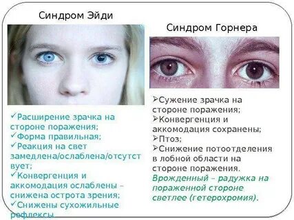 Причины увеличения глаза