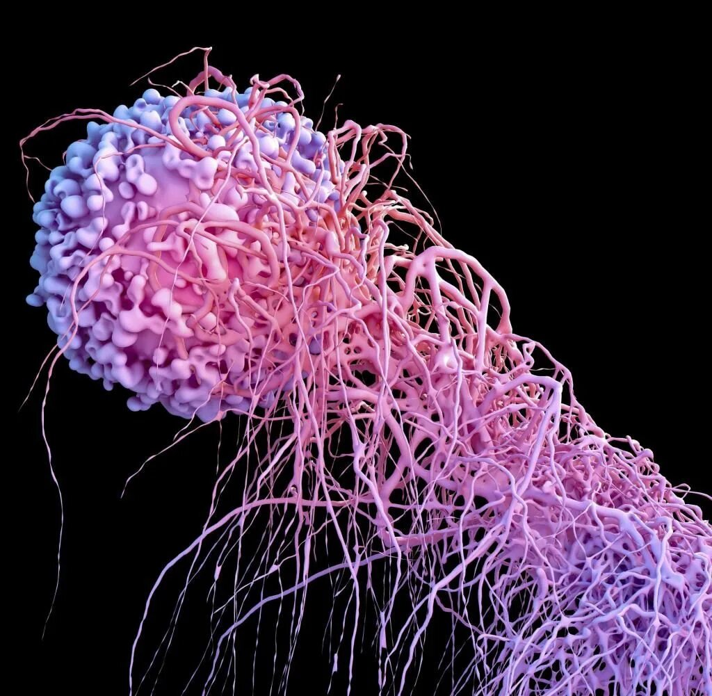 Что такое раковые клетки. Раковые клетки под микроскопом. Зарождение раковой клетки.