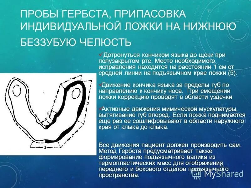 припасовка индивидуальных ложек на верхнюю челюсть