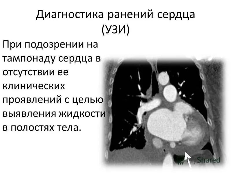 В сердце раны в легких никотин