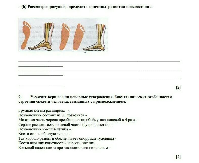 В данных изображениях определи. Строение скелета человека с плоскостопием. Рассмотрите рисунки и выберите верные утверждения:. Рассмотрите рисунок верными утверждениями являются. 63. Рассмотрите рисунки. Определите.