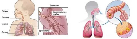 Туберкулез у детей