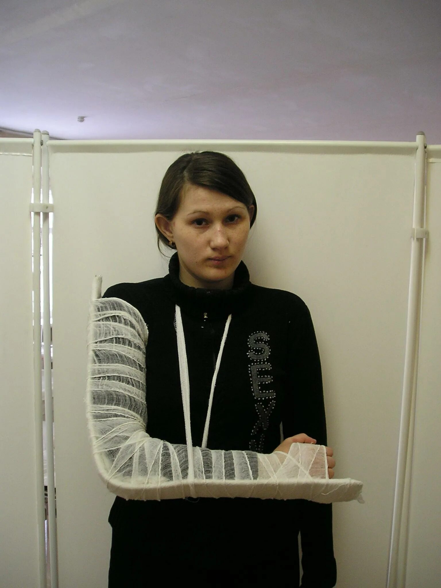 Лестничная крамера. Иммобилизация предплечья шиной крамера. наложение шины крамера при переломе костей предплечья. алгоритм иммобилизации шиной крамера. перелом плечевой кости шина крамера.