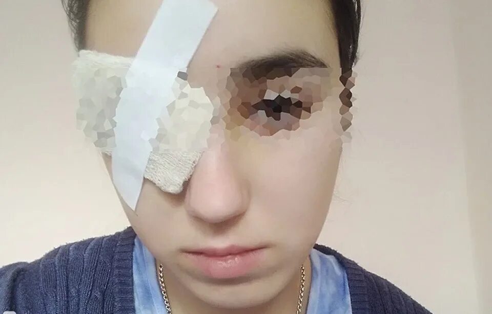 Девочка без глаза