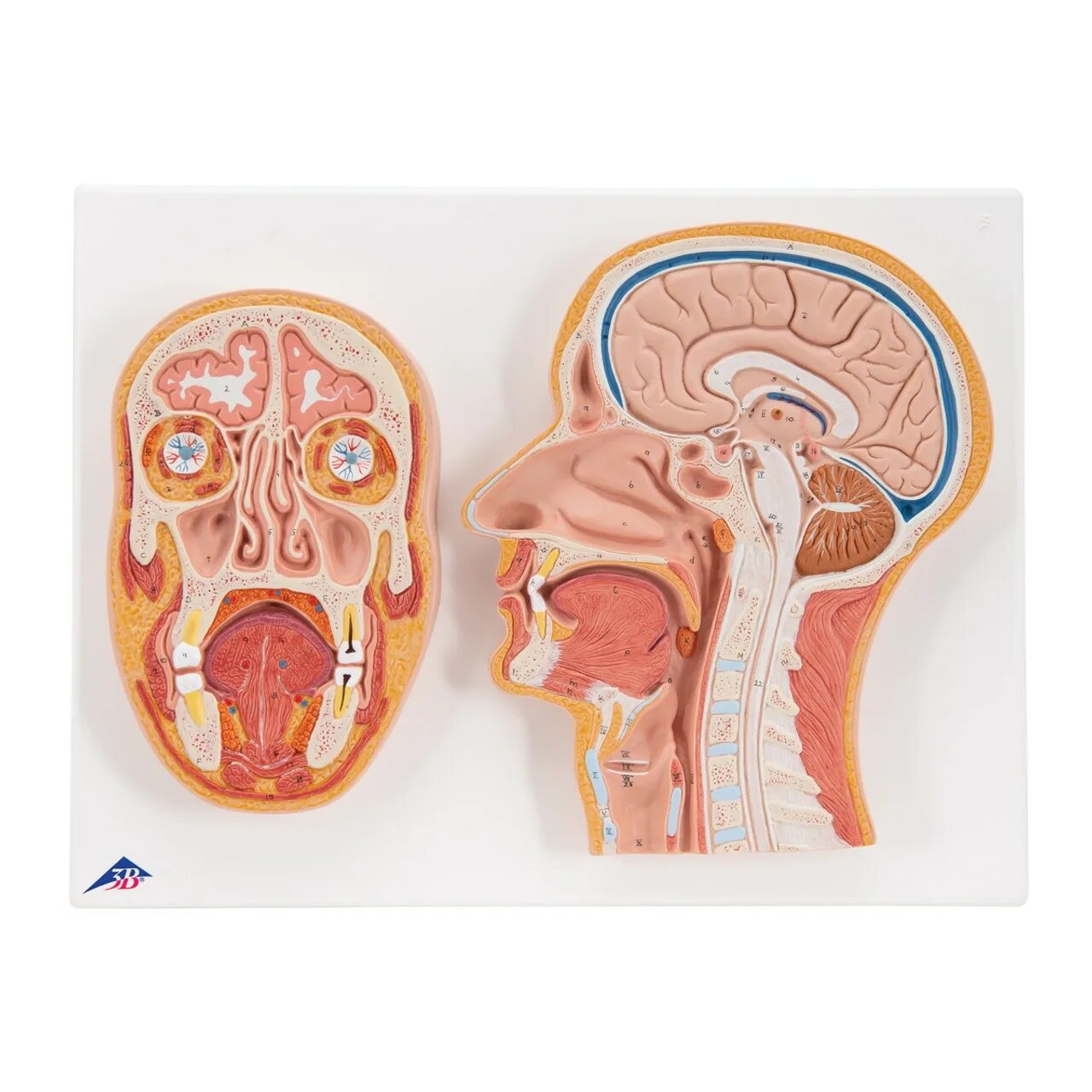 Сагиттальный распил головы человека. Аденома гипофиза гистология. Человек срез. Сагиттальный распил черепа анатомия. Человек срез.