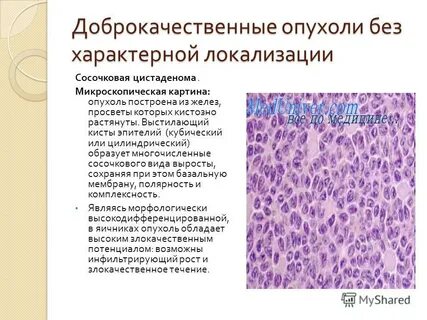 Доброкачественная ткань