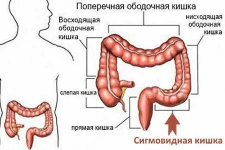 Сигмовидная кишка где находится и симптомы. Сигмовидный отдел толстой кишки. ободочная кишка сигмовидная кишка. сигмовидный отдел толстого кишечника. восходящий отдел поперечно-ободочной кишки.