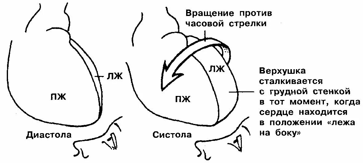 Поворот сердца правым желудочком вперед что это. Повороты сердца на ЭКГ вокруг продольной оси. Поворот сердца против часовой стрелки. Вращение против часовой стрелки. Поворот сердца вокруг продольной оси.