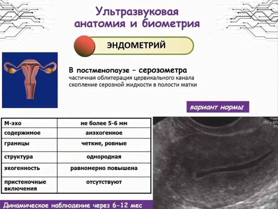 Эндометрия в постменопаузе. Полип эндометрия в постменопаузе на УЗИ. Узлы эндометрия