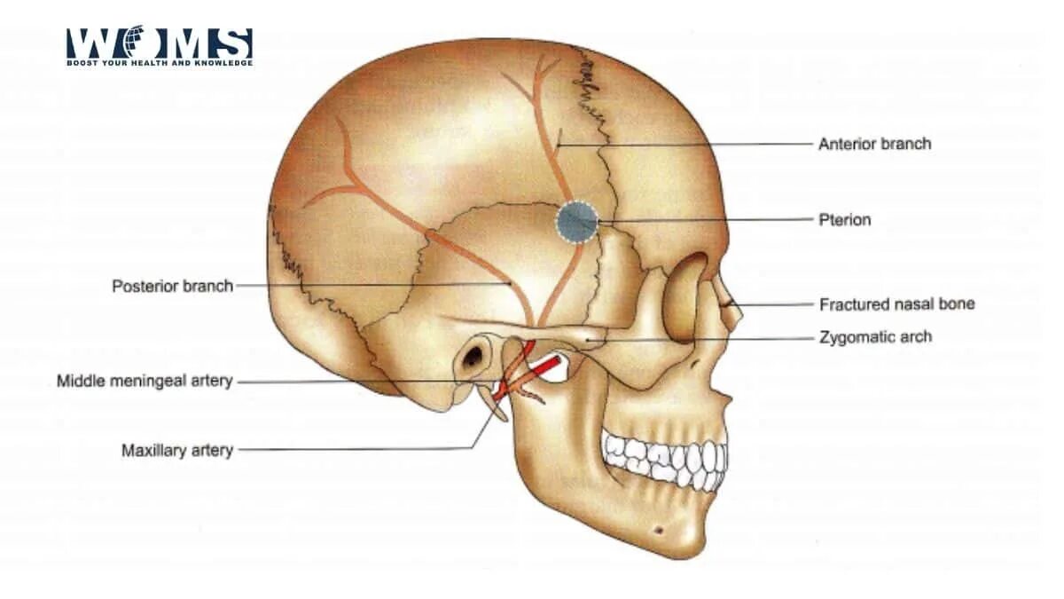 A meningea Media ветвь. Pterion анатомия. Средняя менингеальная артерия анатомия.