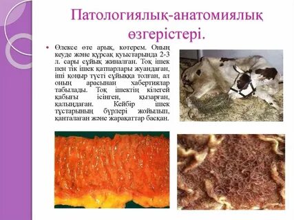 Нәпсінің порнографиясын қараңыз