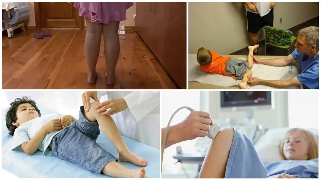 Ребенок выпрямляет ножки. Массаж при запоре у новорожденного. Ребенок ползает. Кривые ножки у новорожденного. Позы от газиков у новорожденных.