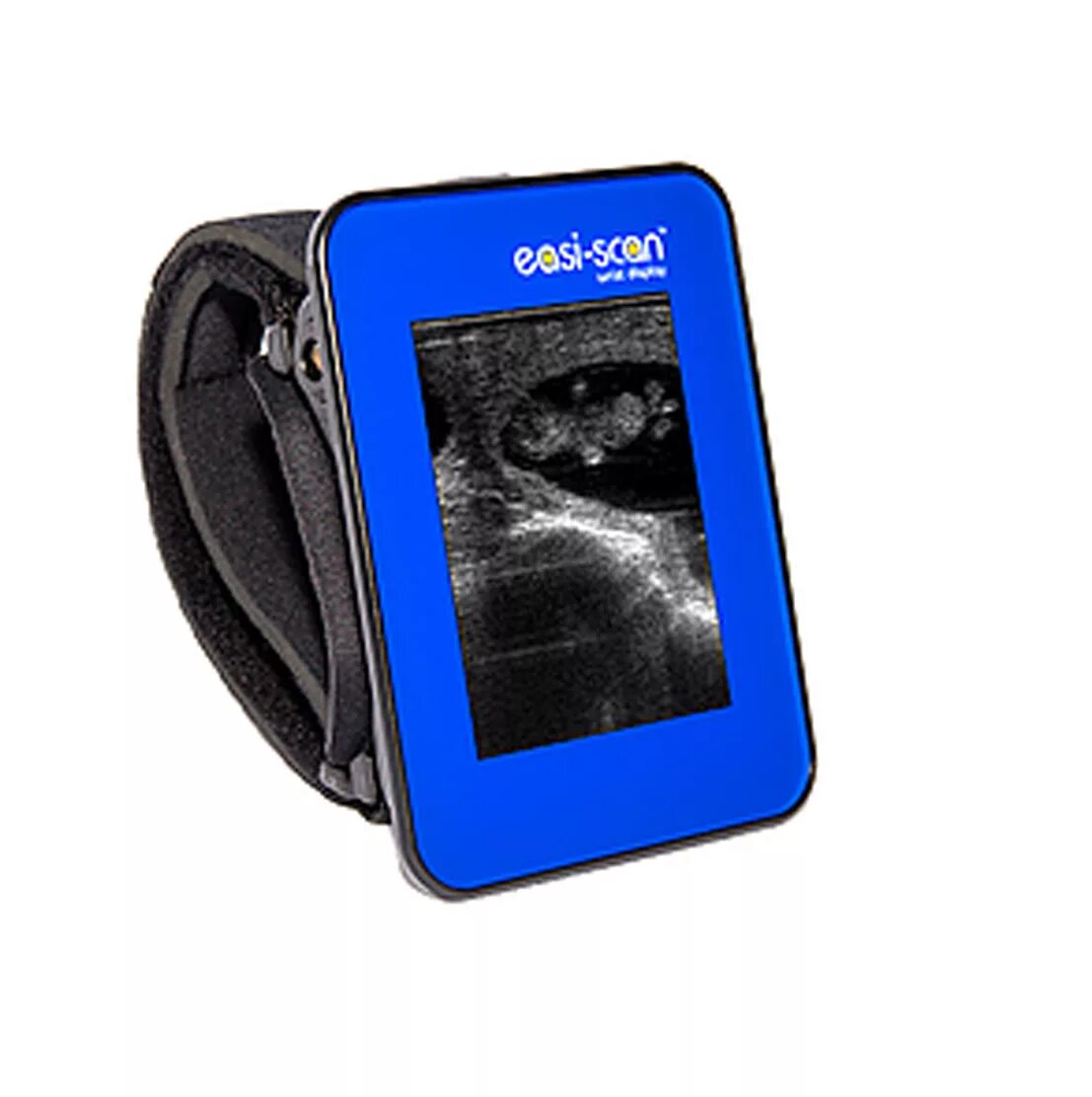 Скан го. Узи сканер изи скан. узи сканер easi scan. ветеринарный узи-сканер easi-scan:go. узи скан аппарат для коров.