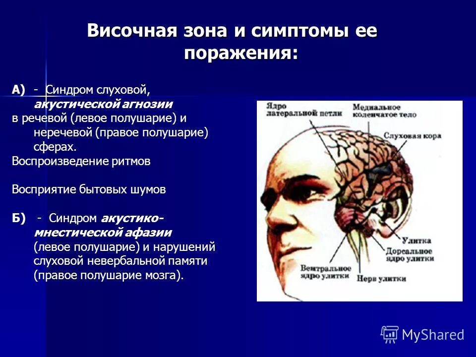 Улучшение функции мозга. Зоны височной доли. Височная зона мозга. Височная зона коры.