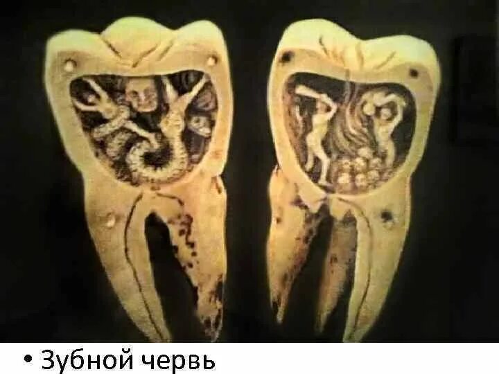 Черви едят зубы. Черви едят зубы