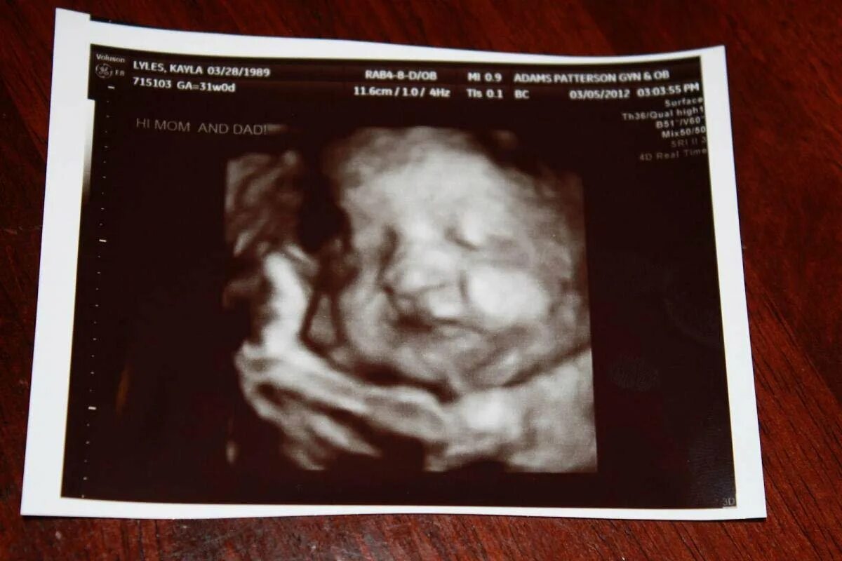 Снимок УЗИ 32 недели беременности. Фото УЗИ 32 недели беременности. 31 Неделя беременности фото УЗИ ребенка. УЗИ ребенка в животе. Вес плода на 32 неделе