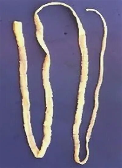 File:Canine roundworm 1.JPG - Wikipedia