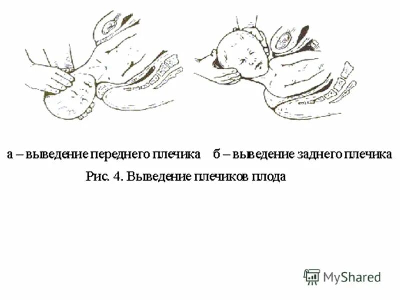 Плод тест 1. Оказание акушерского пособия в родах. Акушерское пособие при физиологических родах алгоритм. Акушерское пособие при головном предлежании. Окажите акушерское пособие в родах..