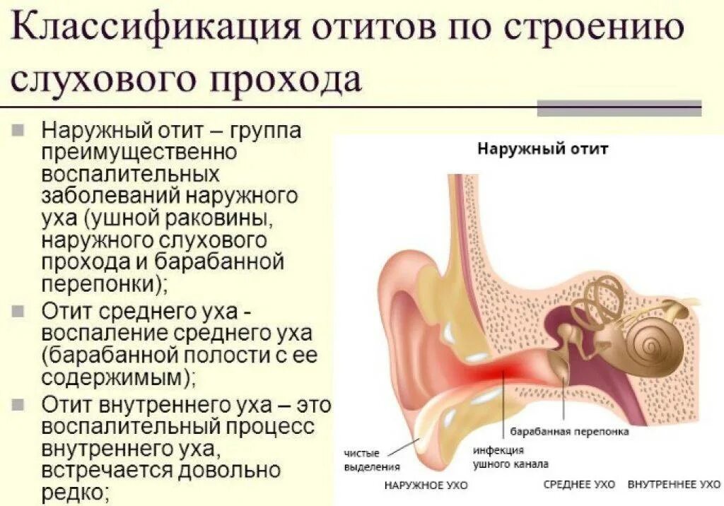 Атит что такое и как лечить