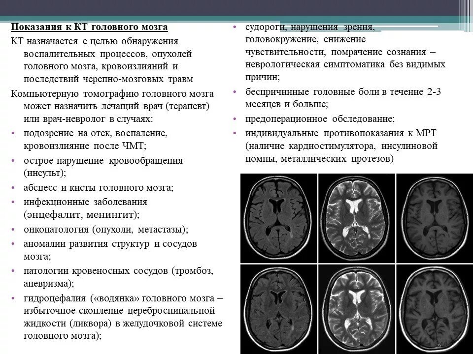 Кт при абсцессе головного мозга. Абсцесс головного мозга кт. Показания к кт мозга. Показания к кт головного мозга. Диагнозы опухоли мозга