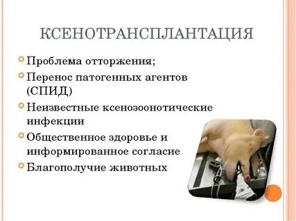 Социальное отторжение