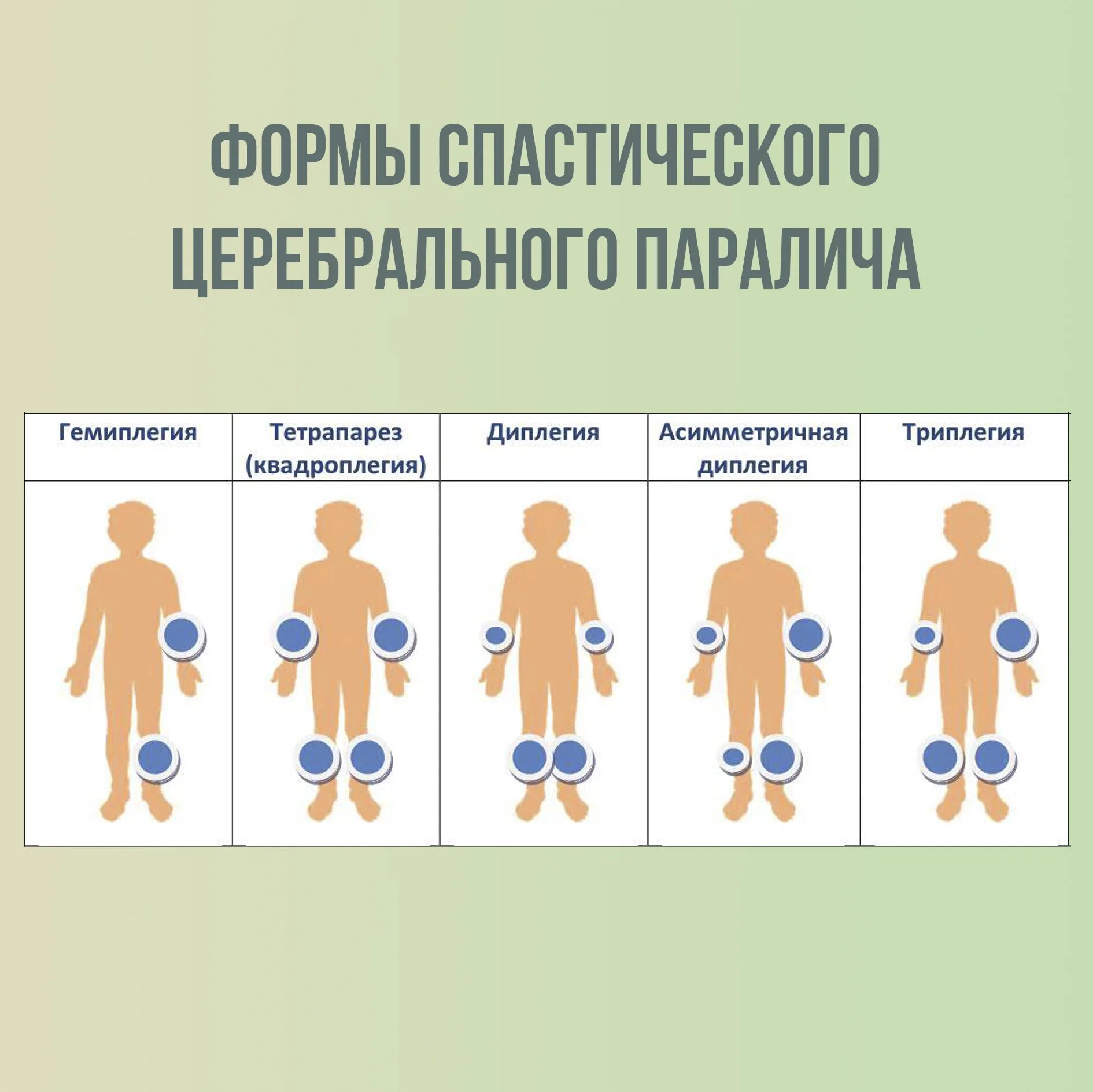 Дцп диплегия. Спастическая форма ДЦП. Спастическая диплегия форма ДЦП. Спастический церебральный паралич. Спастический тетрапарез.