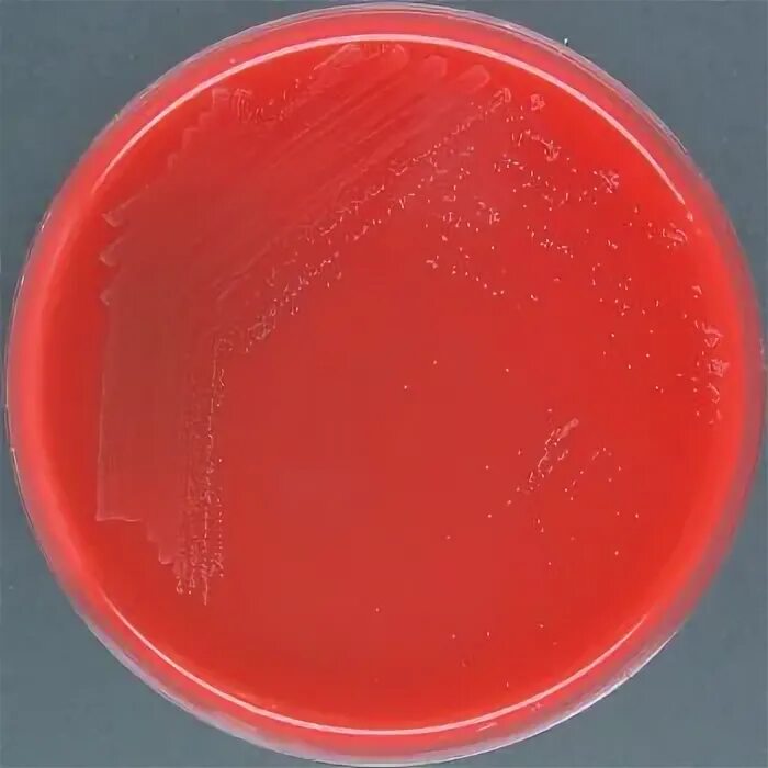 Streptococcus viridans у ребенка. Streptococcus viridans кровяной агар. фузобактерия на кровяном агаре.
