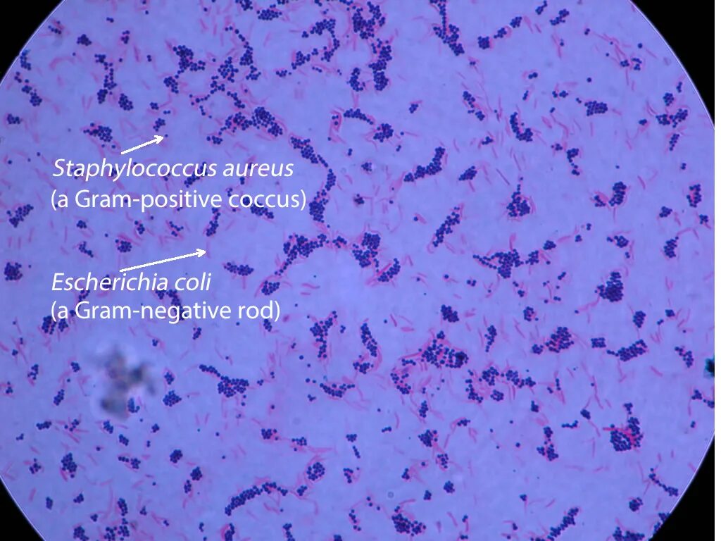 Staphylococcus e coli. Escherichia coli в микроскопе. escherichia coli под микроскопом. эшерихия коли под микроскопом. эшерихии по граму микроскоп.