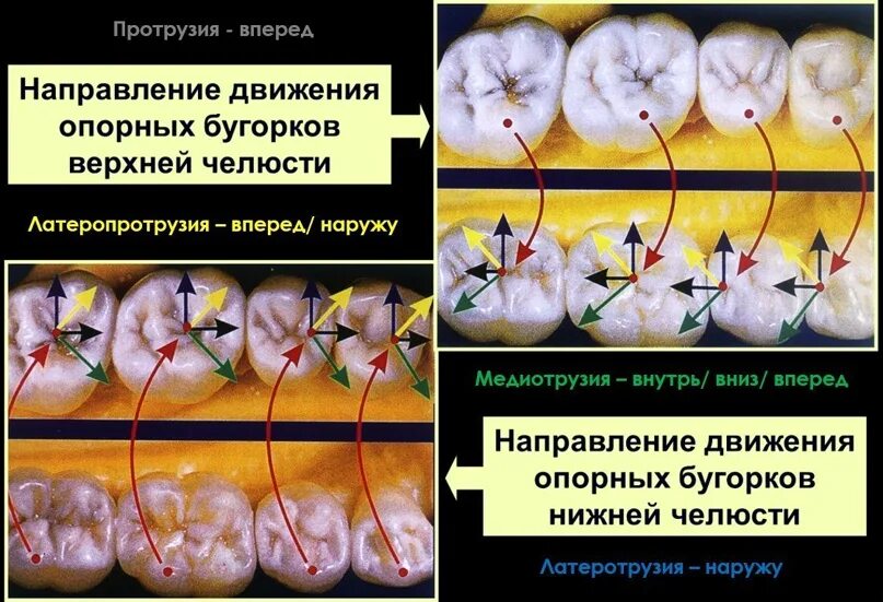 Компас зуба. Окклюзионный компас зуба. Окклюзионный компас Славичек. Окклюзионный компас жевательных зубов. Окклюзионный компас по Шульцу.