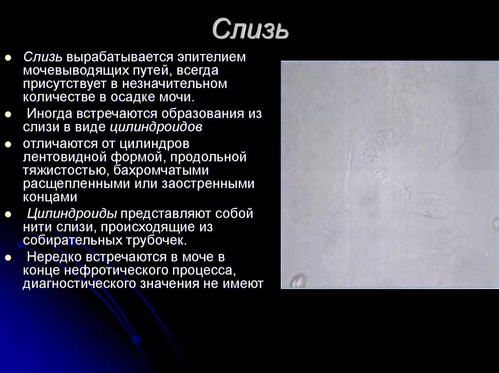 Почему много слизи. Слизь в моче. наличие слизи в моче причины. слизь в моче у мужчин в большом количестве причины. слизь в моче у ребенка.