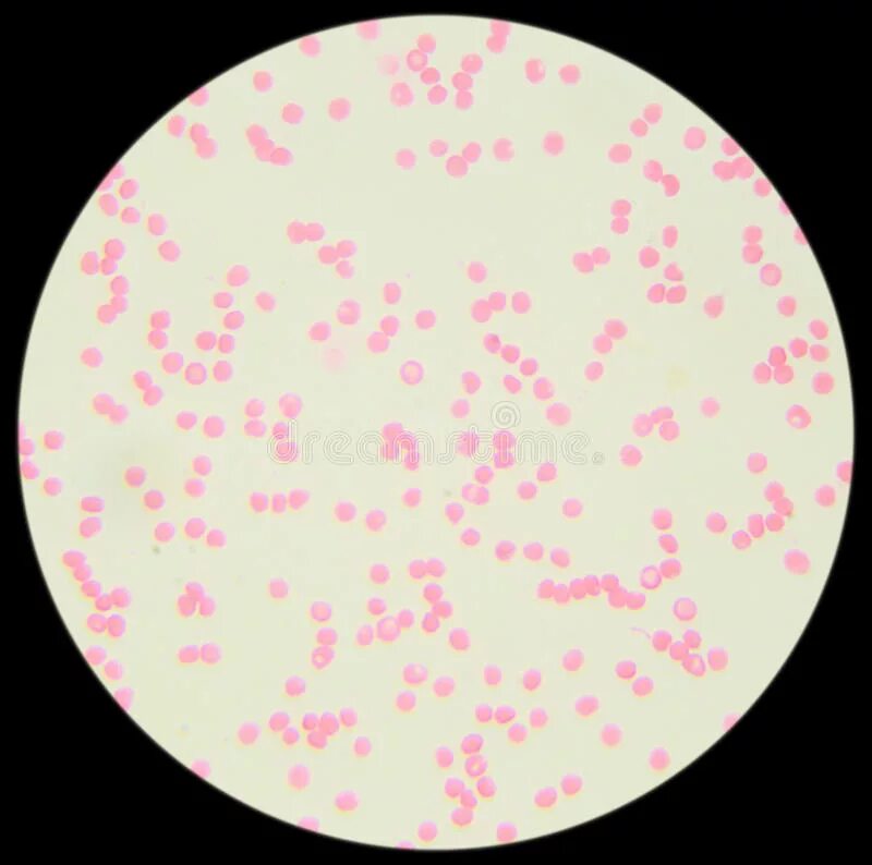 Мазок сальмонеллы. Эширихия колли микроскоп. Эшерихии кишечная палочка. Сальмонелла тифи окраска по граму. Salmonella enteritidis мазок.