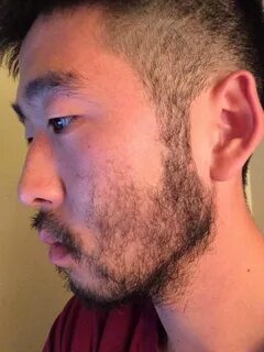 Facial hair