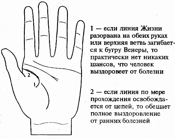 Линия жизни на левой руке. Линия судьбы на левой руке. Линия жизни на левой ладони. Разрыв линии жизни на левой руке.